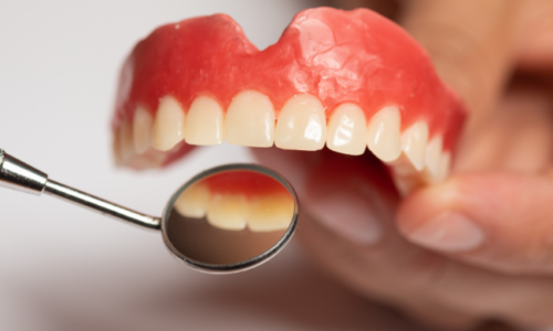 What Are Dentures What Are Dentures