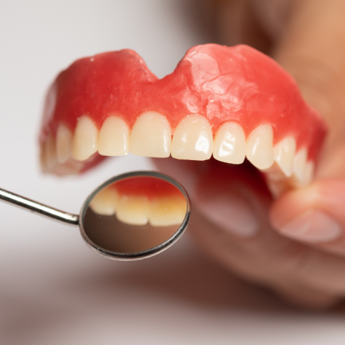 What Are Dentures