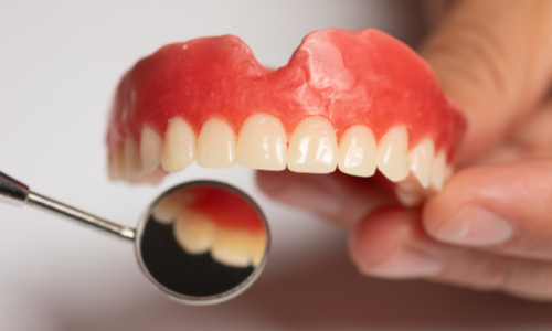 What Is Snap-In Denture