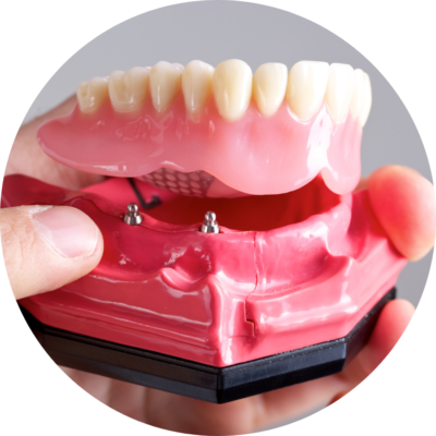 Snap-In Dentures - Landing Page